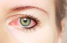 Ochiul roșu poate indica probleme grave de sănătate