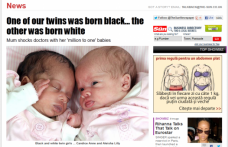 INCREDIBIL: Două gemene s-au născut una albă şi cealaltă neagră 