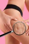 Informații importante despre lupta cu celulita, în mod natural