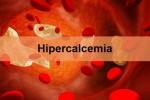 hipercalcemia