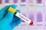 dieta-scaderea-trigliceridelor