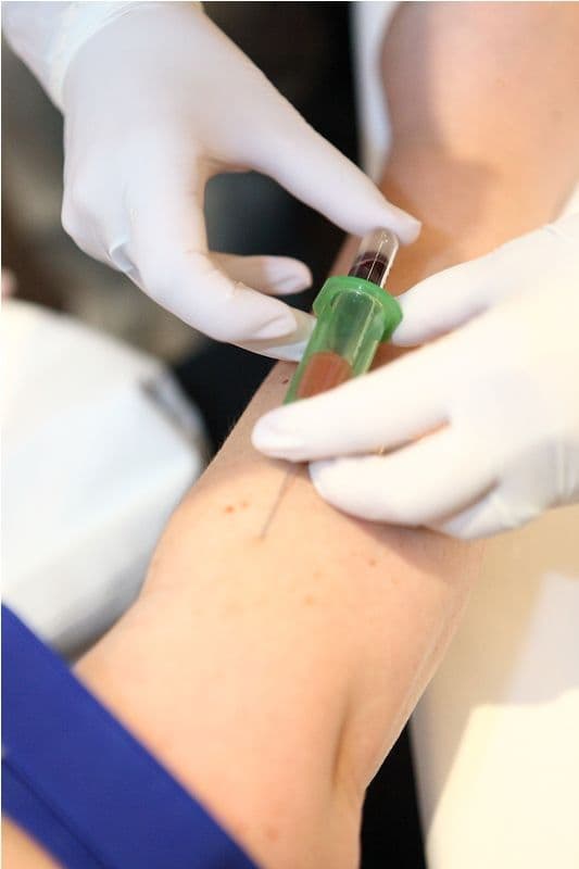 Testări gratuite pentru depistarea infecției cu Hepatita C, în Botoșani