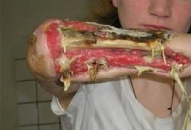 Crocodil, drogul care mănâncă dependenții, a ajuns în Europa