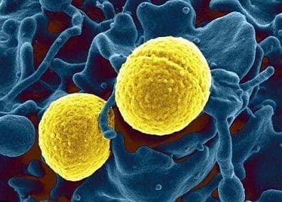 Bacteria care a îngrozit Europa. Se poate lua în autobuz şi îţi poate ataca plămânii
