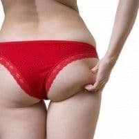 Soluţii ca să-ţi ascunzi vergeturile când te îmbraci în fustă