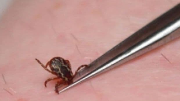 Cum să tratezi înţepătura de căpuşă cu tinctură de propolis