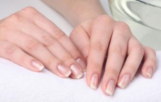 Vezi de ce poţi boli poţi suferi! Ce probleme de sănătate dezvăluie unghiile tale!