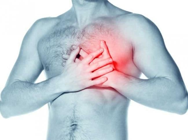 Risc de infarct de la diclofenac