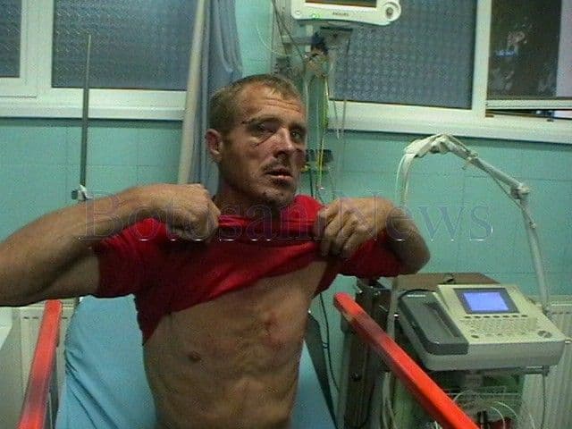 Bărbat ajuns la spital bătut de fosta soție nemulțumită de bunurile primite la partaj - Vezi VIDEO cu bătaia