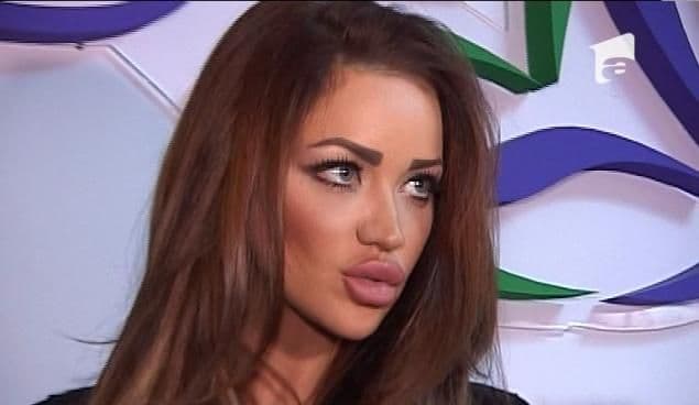 Bianca Drăgușanu o dă în extremă! Și-a mărit buzele, dar așa de mari nu le-a avut până acum