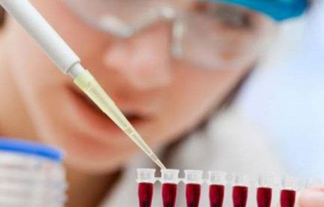 Semnal de alarmă: 250 de cazuri de hepatită A, în acest an. Majoritatea, la copii între 5 şi 9 ani