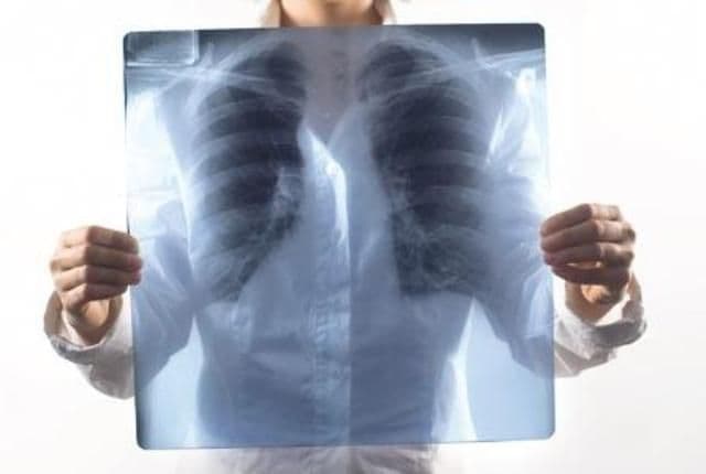 Toți fumătorii trebuie să știe asta. Cel mai bun remediu natural pentru curățarea plămânilor