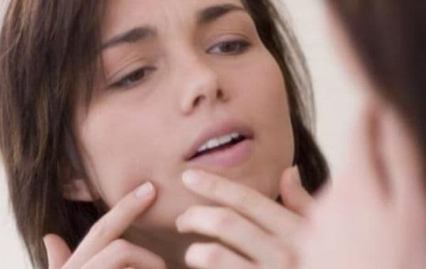 Leacuri pentru pielea uscată și roșeață facială