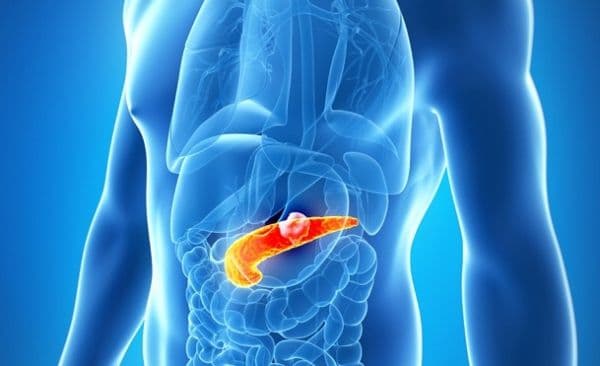 Cum prevenim cel mai ucigător tip de cancer, cel de pancreas