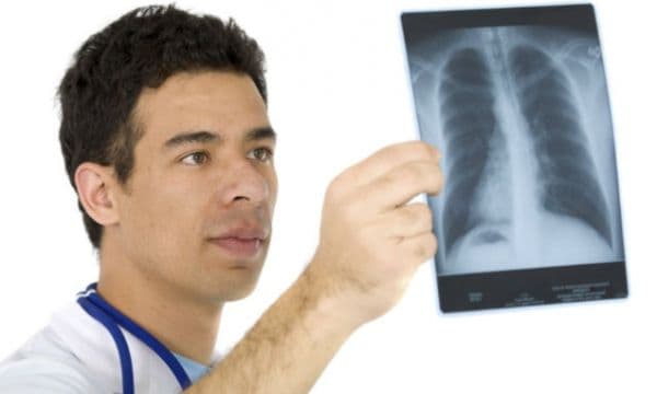 Toți fumătorii trebuie să știe asta. Cel mai bun remediu natural pentru curățarea plămânilor