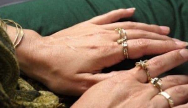 Şi tu porţi bijuterii de aur? Boală curată pentru trei organe vitale
