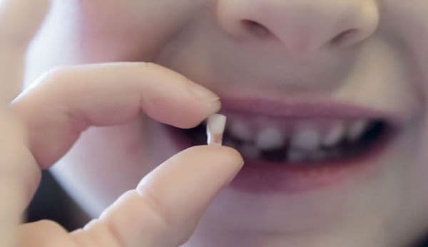 Atenţie, părinţi! De ce să nu aruncaţi dinţii de lapte ai copiilor: le-ar putea salva viaţa!