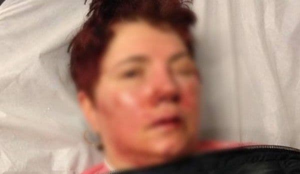 Panică și groază pe străzile din Botoșani! Cinci femei au fost bătute și jefuite