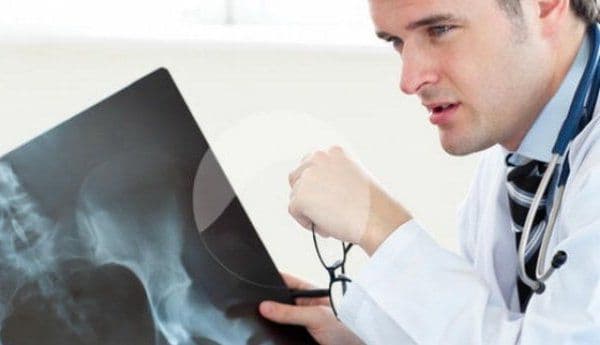 Câte radiografii putem face fără să fim în pericol