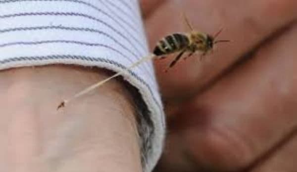 Cum să tratezi acasă înțepăturile de insecte. Uite cât de simplu e