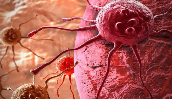 Medicii trag un semnal de alarmă: Lipsa acestei vitamine duce la apariţia cancerului!
