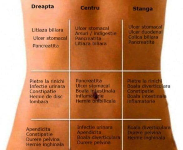 harta durerilor de stomac