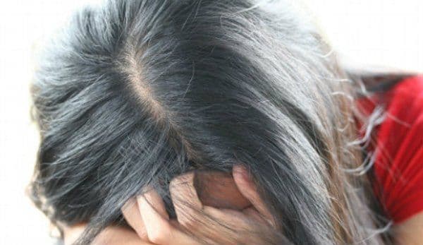 Ţi-a albit părul prematur? Ce boli grave poate ascunde acest lucru