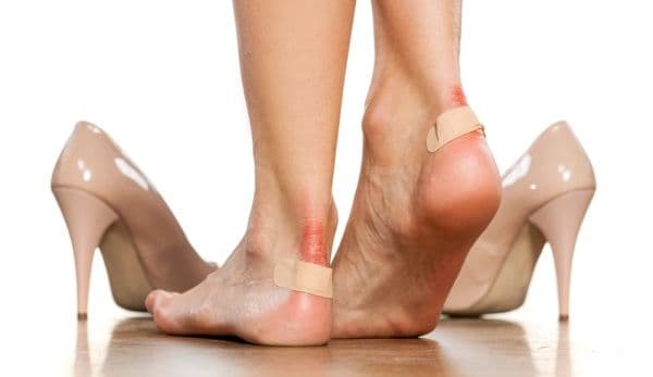 Cele mai bune tratamente naturiste pentru băşici