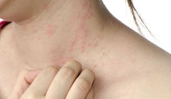 Ce se întâmplă în organism când stai mult la soare