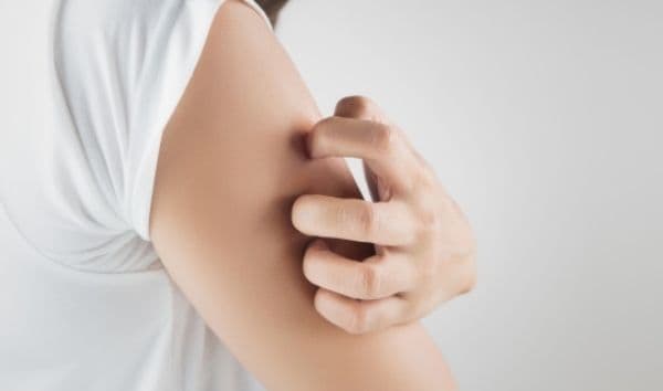 Remediu naturist care tratează iritațiile și eczemele