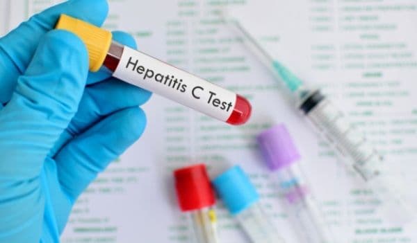 Ce trebuie să ştii despre hepatita C