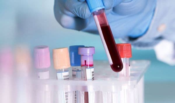 Un test sangvin ar putea detecta cancerul la sân cu cinci ani înainte de apariția simptomelor