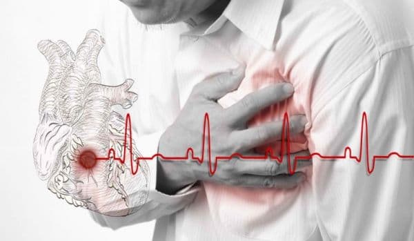 Testul de sânge care evidențiază existența unui infarct miocardic