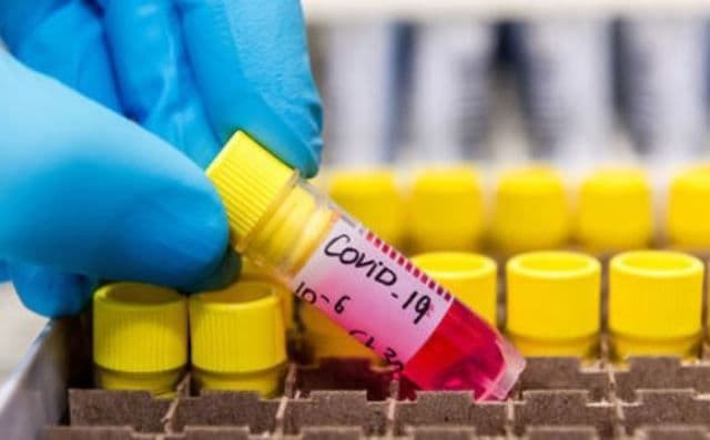 Statistică la nivel național: Peste 150 de cadre medicale și personal auxiliar confirmate cu COVID-19