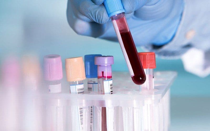 Trei teste medicale care îţi pot salva viaţa