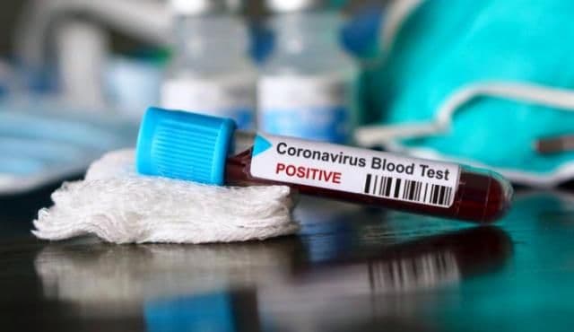 Coronavirus în România, 6 septembrie. Număr mare de cazuri noi de infectări în week-end
