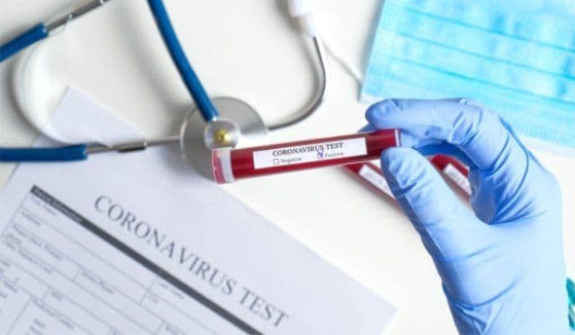 Bilanț infectări cu COVID-19. Vezi cum au evoluat cazurile noi și numărul testelor efectuate în ultimele zile