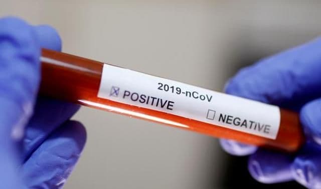 Coronavirus 30 octombrie. Din nou record negativ! Peste 6.500 de infectări cu COVID