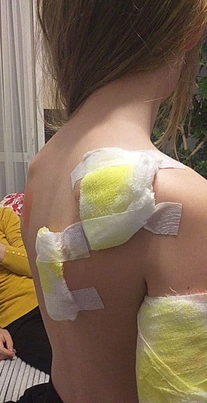 Revoltător! Doi adulți și o fetiță de 11 ani mușcate de un câine la Botoșani - FOTO