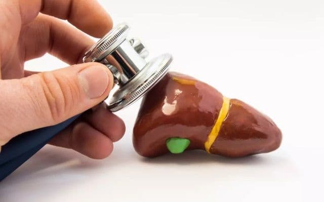 Boala ficatului gras. Descoperirea șocantă a doctorilor. Cum apare afecțiunea