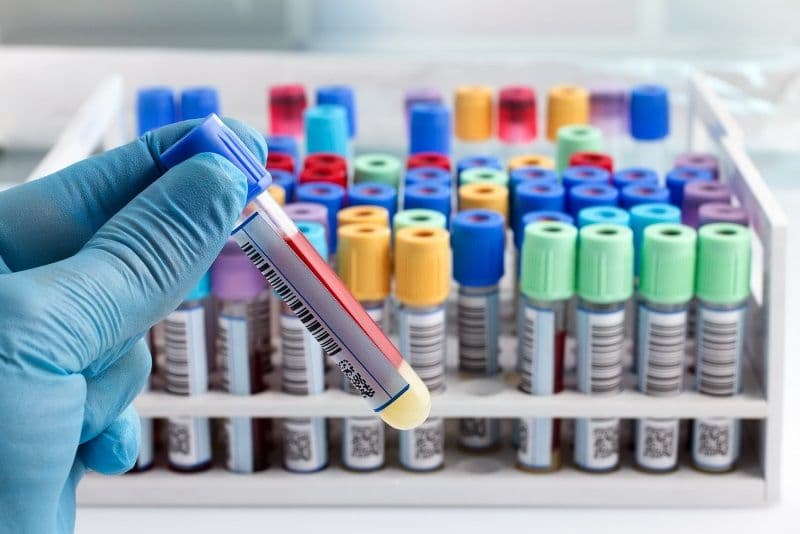 Laboratorul de analize medicale din cadrul Spitalului Dorohoi se va muta în două containere