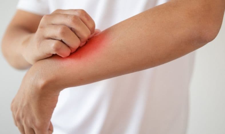 Informații despre boala numită dermatomiozită