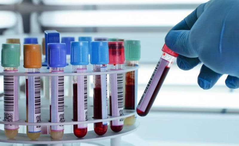 Cum beneficiezi de investigații medicale gratuite în maximum 5 zile de la solicitare, indiferent de epuizarea plafonului: 5 pași simpli