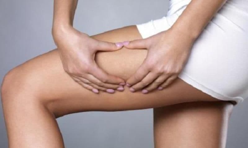 Dieta care ne poate scăpa de celulită