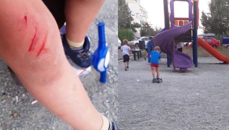Cum procedăm când copiii se rănesc la joacă