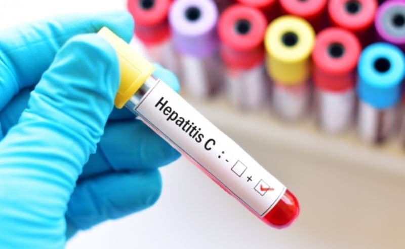 Start la testarea pentru hepatite în județele Botoșani și Buzău