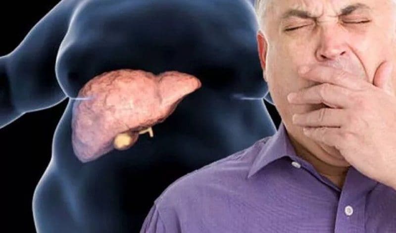 Semne care îți spun că ai un ficat toxic