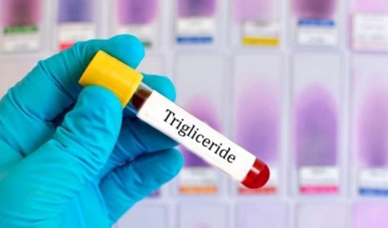 Ce trebuie să facem pentru scăderea trigliceridelor