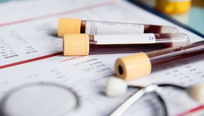 Analize gratuite. CNAS oferă servicii medicale gratuite pentru persoanele de peste 40 de ani