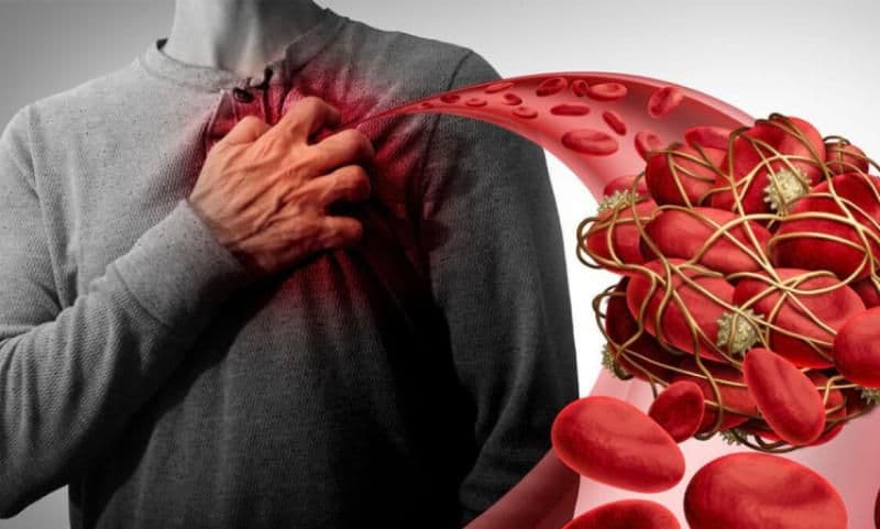 Simptome care vă informează despre prezența un cheag de sânge în corp